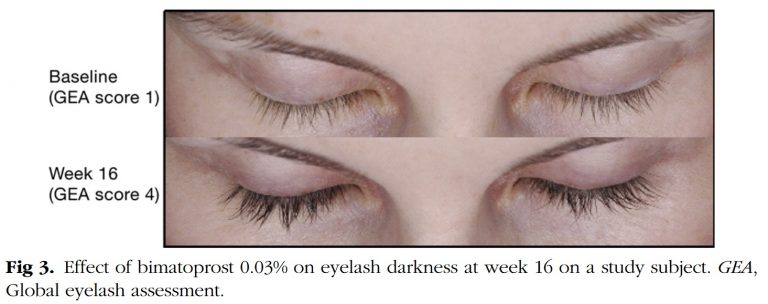 Effect bimatoprost op wimpergroei Smith et al. 2012