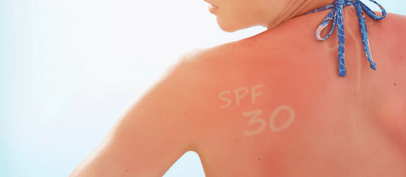 Top 5 Beste zonnebrand