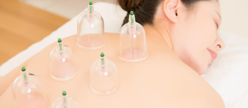Cupping Cups kopen? De lekkerste Massage met deze Cups!