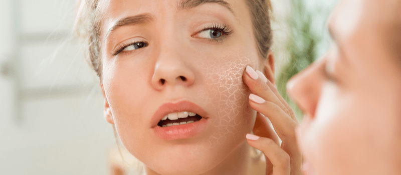 Alles over de beste serums voor een droge huid! Bekijk hier snel de TOP 5!