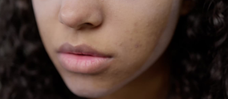 Gezichtsverzorging tegen pigmentvlekken? Het kan bekijk onze Top 5! 2 Met wat voor soort producten kun je pigmentvlekken behandelen