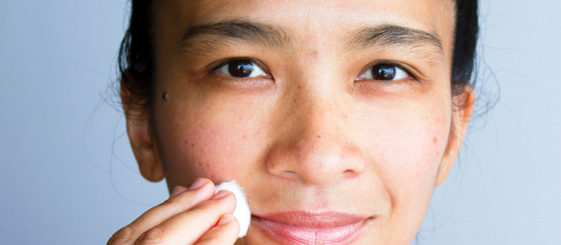 Anti Acne Creme, bestaat het en welke moet ik kopen? Top 5 voor jou!